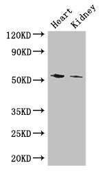 Western Blot
Positive WB detected in: Mouse heart tissue, Mouse kidney tissue
All lanes: CYP11B1 antibody at 3ug/ml
Secondary
Goat polyclonal to rabbit IgG at 1/50000 dilution
Predicted band size: 58, 50 kDa
Observed band size: 58 kDa