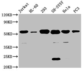 Western Blot
Positive WB detected in: Jurkat whole cell lysate, HL60 whole cell lysate, 293 whole cell lysate, SH-SY5Y whole cell lysate, Hela whole cell lysate, PC-3 whole cell lysate
All lanes: CYP21A2 antibody at 8µg/ml
Secondary
Goat polyclonal to rabbit IgG at 1/50000 dilution
Predicted band size: 56, 53 kDa
Observed band size: 56 kDa