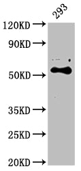 Western Blot
Positive WB detected in: 293 whole cell lysate
All lanes: CYP27B1 antibody at 1:2000
Secondary
Goat polyclonal to rabbit IgG at 1/50000 dilution
Predicted band size: 57 kDa
Observed band size: 57 kDa