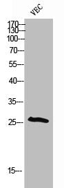 Western Blot analysis of VEC cells using Phospho-p27 (T198) Polyclonal Antibody