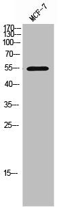Western Blot analysis of MCF-7 cells using Chk1 Polyclonal Antibody