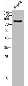 Western Blot analysis of HepG2 cells using CPTI-M Polyclonal Antibody