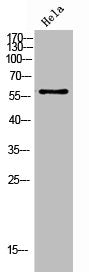 Phospho-CHEK2 (T383) Antibody – Figure 1 of 1