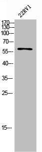 CHEK2 Antibody – Figure 1 of 1