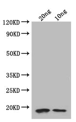 Western Blot
Positive WB detected in: recombinant protein
All lanes: folA Antibody at 1:1000
Secondary
Goat polyclonal to rabbit IgG at 1/50000 dilution
Predicted band size: 18.8 kDa
Observed band size: 19 kDa