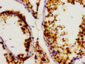 Immunohistochemistry of paraffin-embedded human testis tissue using CSB-PA006854LA01HU at dilution of 1:100