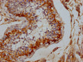 IHC image of CSB-PA006938LA01HU diluted at 1:100 and staining in paraffin-embedded human testis tissue performed on a Leica BondTM system. After dewaxing and hydration, antigen retrieval was mediated by high pressure in a citrate buffer (pH 6.0). Section was blocked with 10% normal goat serum 30min at RT. Then primary antibody (1% BSA) was incubated at 4°C overnight. The primary is detected by a Goat anti-rabbit IgG labeled by HRP and visualized using 0.05% DAB.