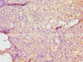 Immunohistochemistry of paraffin-embedded human tonsil tissue using CSB-PA006967DSR2HU at dilution of 1:100