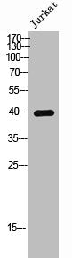 Western Blot analysis of Jurkat cells using Phospho-CKR-5 (S336) Polyclonal Antibody