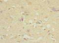 Immunohistochemistry of paraffin-embedded human brain tissue using CSB-PA007008DSR1HU at dilution of 1:100