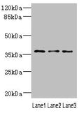 Western blot All lanes: DNAJB2 antibody at 1.18ug/ml Lane 1: 293T whole cell lysate Lane 2: PC-3 whole cell lysate Lane 3: A431 whole cell lysate Secondary Goat polyclonal to rabbit IgG at 1/10000 dilution Predicted band size: 36, 31 kDa Observed band size: 36 kDa