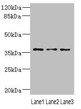 Western blot All lanes: DNAJB2 antibody at 1.18ug/ml Lane 1: 293T whole cell lysate Lane 2: PC-3 whole cell lysate Lane 3: A431 whole cell lysate Secondary Goat polyclonal to rabbit IgG at 1/10000 dilution Predicted band size: 36, 31 kDa Observed band size: 36 kDa