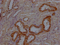 IHC image of CSB-PA007079LA01HU diluted at 1:200 and staining in paraffin-embedded human kidney tissue performed on a Leica BondTM system. After dewaxing and hydration, antigen retrieval was mediated by high pressure in a citrate buffer (pH 6.0). Section was blocked with 10% normal goat serum 30min at RT. Then primary antibody (1% BSA) was incubated at 4°C overnight. The primary is detected by a Goat anti-rabbit polymer IgG labeled by HRP and visualized using 0.05% DAB.