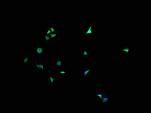 Immunofluorescence staining of Hela cells with CSB-PA007079LA11HU at 1:200, counter-stained with DAPI. The cells were fixed in 4% formaldehyde and blocked in 10% normal Goat Serum. The cells were then incubated with the antibody overnight at 4°C. The secondary antibody was Alexa Fluor 488-congugated AffiniPure Goat Anti-Rabbit IgG(H+L).