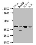 Western Blot
Positive WB detected in: Hela whole cell lysate, HepG2 whole cell lysate, MCF-7 whole cell lysate, PC3 whole cell lysate
All lanes: DUSP11 antibody at 1:2000
Secondary
Goat polyclonal to rabbit IgG at 1/50000 dilution
Predicted band size: 39, 26 kDa
Observed band size: 39 kDa
