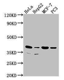 Western Blot
Positive WB detected in: Hela whole cell lysate, HepG2 whole cell lysate, MCF-7 whole cell lysate, PC3 whole cell lysate
All lanes: DUSP11 antibody at 1:2000
Secondary
Goat polyclonal to rabbit IgG at 1/50000 dilution
Predicted band size: 39, 26 kDa
Observed band size: 39 kDa