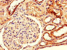 Immunohistochemistry of paraffin-embedded human kidney tissue using CSB-PA007255LA01HU at dilution of 1:100