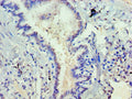 Immunohistochemistry of paraffin-embedded human lung tissue using CSB-PA007286ESR2HU at dilution of 1:100