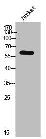 Western Blot analysis of JK cells using AR-α1B Polyclonal Antibody