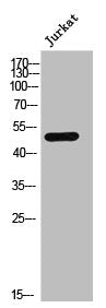 Western Blot analysis of JK cells using AR-α1A Polyclonal Antibody