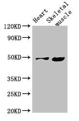 Western Blot
Positive WB detected in: Mouse heart tissue, Mouse skeletal muscle tissue
All lanes: EDNRB antibody at 4µg/ml
Secondary
Goat polyclonal to rabbit IgG at 1/50000 dilution
Predicted band size: 50, 49, 60 kDa
Observed band size: 50 kDa