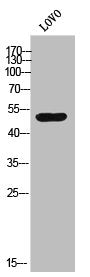 Western Blot analysis of lOVO cells using AR-α1A Polyclonal Antibody