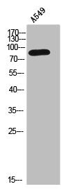 Western Blot analysis of A549 cells using Catenin-β Polyclonal Antibody