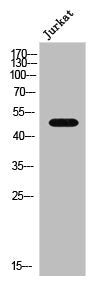 Western Blot analysis of Jurkat cells using AR α2A Polyclonal Antibody