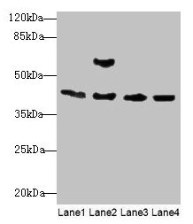 Western blot
All lanes: Acta1 antibody at 2µg/ml
Lane 1: Mouse brain tissue
Lane 2: Mouse lung tissue
Lane 3: Rat muscle tissue
Lane 4: Zebrafish lysate
Secondary
Goat polyclonal to rabbit IgG at 1/10000 dilution
Predicted band size: 43 kDa
Observed band size: 43 kDa