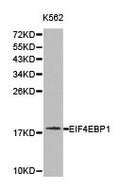 Western blot analysis of K562 cell lysate ,using EIF4EBP1 antibody.