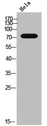 Western Blot analysis of Hela cells using GRK 2 Polyclonal Antibody