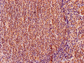 IHC image of CSB-PA007573HA01HU diluted at 1:200 and staining in paraffin-embedded human tonsil tissue performed on a Leica BondTM system. After dewaxing and hydration, antigen retrieval was mediated by high pressure in a citrate buffer (pH 6.0). Section was blocked with 10% normal goat serum 30min at RT. Then primary antibody (1% BSA) was incubated at 4°C overnight. The primary is detected by a Goat anti-rabbit polymer IgG labeled by HRP and visualized using 0.05% DAB.