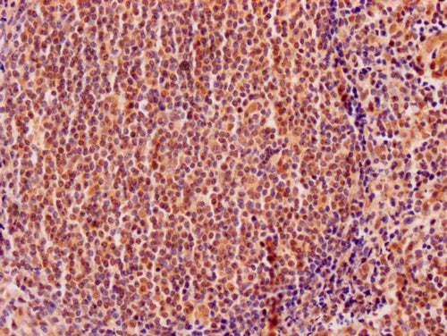 IHC image of CSB-PA007573HA01HU diluted at 1:200 and staining in paraffin-embedded human tonsil tissue performed on a Leica BondTM system. After dewaxing and hydration, antigen retrieval was mediated by high pressure in a citrate buffer (pH 6.0). Section was blocked with 10% normal goat serum 30min at RT. Then primary antibody (1% BSA) was incubated at 4°C overnight. The primary is detected by a Goat anti-rabbit polymer IgG labeled by HRP and visualized using 0.05% DAB.