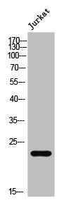Western Blot analysis of Jurkat cells using AKAP 14 Polyclonal Antibody