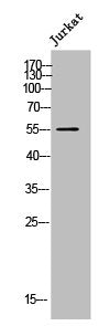 Western Blot analysis of JK cells using CYP21A2 Polyclonal Antibody
