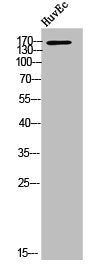 Western Blot analysis of HuvEc cells using ACE1 Polyclonal Antibody