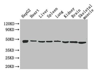 Western Blot
Positive WB detected in: HepG2 whole cell lysate, Mouse heart tissue, Mouse liver tissue, Mouse spleen tissue, Mouse lung tissue, Mouse kidney tissue, Mouse brain tissue, Mouse skeletal muscle tissue
All lanes: Eno1 antibody at 2.6µg/ml
Secondary
Goat polyclonal to rabbit IgG at 1/50000 dilution
Predicted band size: 48 kDa
Observed band size: 48 kDa