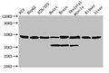 Western Blot
Positive WB detected in: PC-3 whole cell lysate, HepG2 whole cell lysate, NIH/3T3 whole cell lysate, Rat heart tissue, Rat brain tissue, Rat skeletal muscle tissue, Mouse kidney tissue, Mouse liver tissue
All lanes: Eno1 antibody; HRP conjugated at 0.42µg/ml
Predicted band size: 48 kDa
Observed band size: 48, 34 kDa