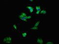 Immunofluorescent analysis of HepG2 cells using CSB-PA007679LA01HU at dilution of 1:100 and Alexa Fluor 488-congugated AffiniPure Goat Anti-Rabbit IgG(H+L)
