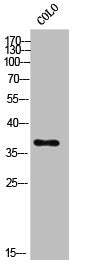 Western Blot analysis of COLO cells using DD2 Polyclonal Antibody