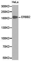 Western blot analysis of extracts of HeLa cell line, using ERBB2 antibody.