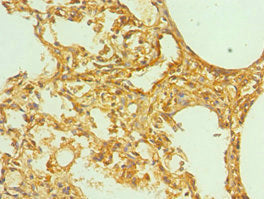 Immunohistochemistry of paraffin-embedded human lung tissue using CSB-PA007765ESR1HU at dilution of 1:100