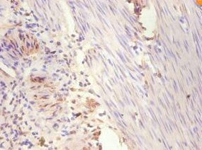 ESR1 Antibody, FITC conjugated – Figure 1 of 2