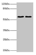 Western blot
All lanes: ESR2 antibody at 2µg/ml
Lane 1: Mouse brain tissue
Lane 2: PC-3 whole cell lysate
Secondary
Goat polyclonal to rabbit IgG at 1/10000 dilution
Predicted band size: 60, 56, 36, 58, 55, 53, 49, 42, 54 kDa
Observed band size: 60 kDa