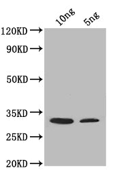 Western Blot
Positive WB detected in: recombinant protein
All lanes: SUP45 Antibody at 1:1000
Secondary
Goat polyclonal to rabbit IgG at 1/50000 dilution
Predicted band size: 32 kDa
Observed band size: 32 kDa