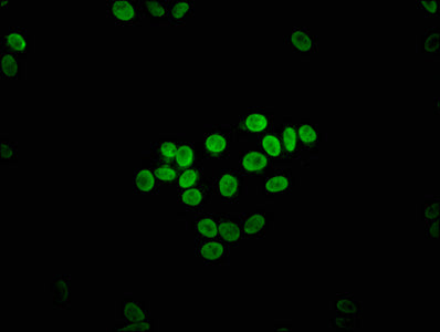 Immunofluorescence staining of HepG2 cells with CSB-PA007855LA01HU at 1:133, counter-stained with DAPI. The cells were fixed in 4% formaldehyde, permeabilized using 0.2% Triton X-100 and blocked in 10% normal Goat Serum. The cells were then incubated with the antibody overnight at 4°C. The secondary antibody was Alexa Fluor 488-congugated AffiniPure Goat Anti-Rabbit IgG(H+L).