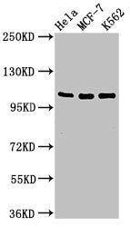 Western Blot
Positive WB detected in: Hela whole cell lysate, MCF-7 whole cell lysate, K562 whole cell lysate
All lanes: EVC antibody at 2ug/ml
Secondary
Goat polyclonal to rabbit IgG at 1/50000 dilution
Predicted band size: 112 kDa
Observed band size: 112 kDa