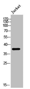 Western Blot analysis of Jurkat cells using EDG-2 Polyclonal Antibody