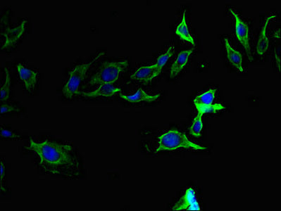 Immunofluorescent analysis of Hela cells using CSB-PA007923LA01HU at dilution of 1:100 and Alexa Fluor 488-congugated AffiniPure Goat Anti-Rabbit IgG(H+L)