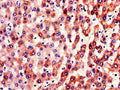 Immunohistochemistry of paraffin-embedded human liver tissue using CSB-PA007936LA01HU at dilution of 1:100
